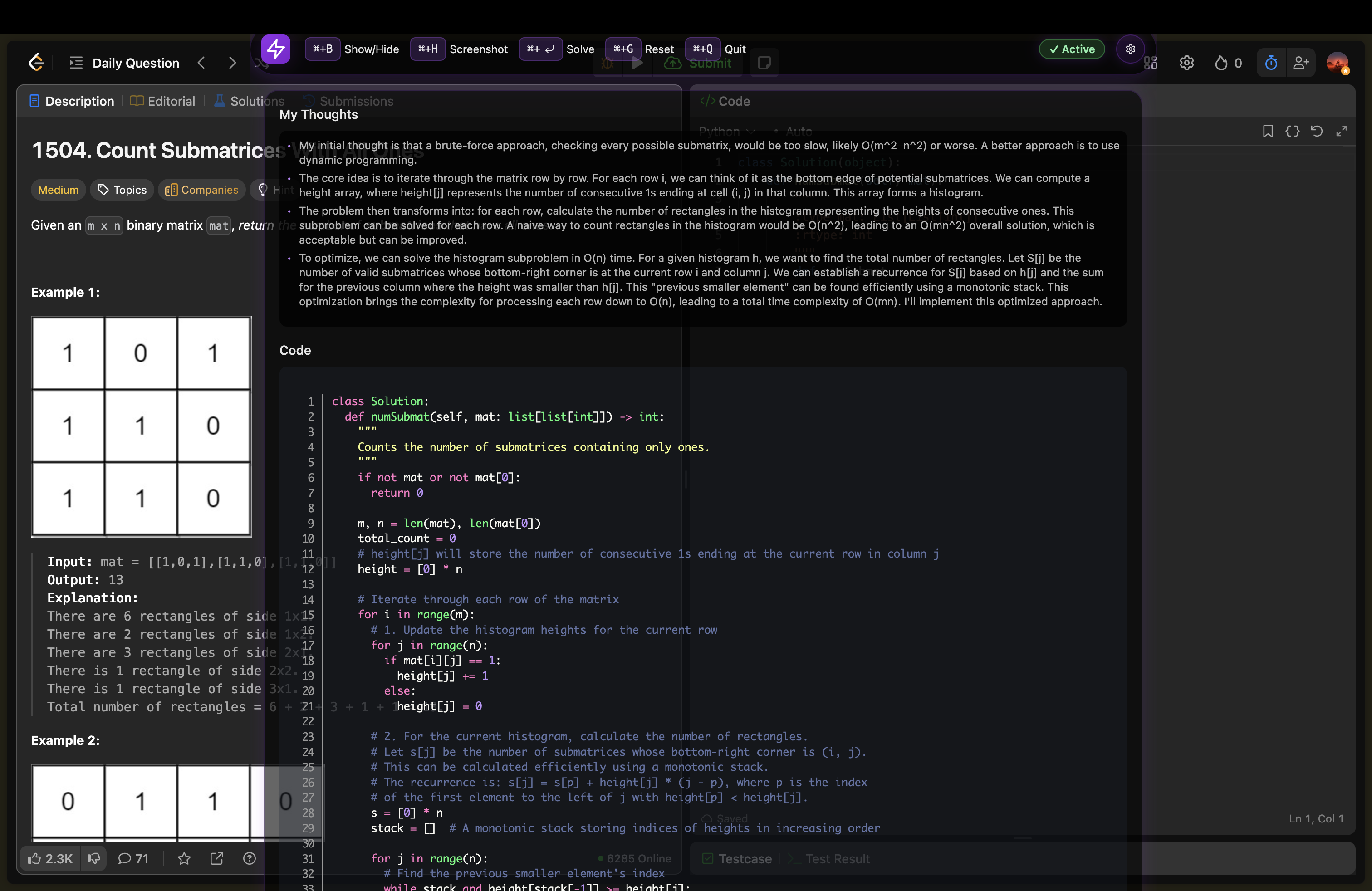 Your view with AI assistance
